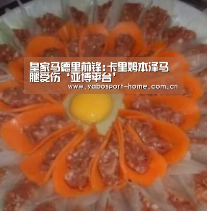 皇家马德里前锋:卡里姆本泽马腿受伤‘亚博平台’(图2) 亚博体育作为国际顶级的综合娱乐平台